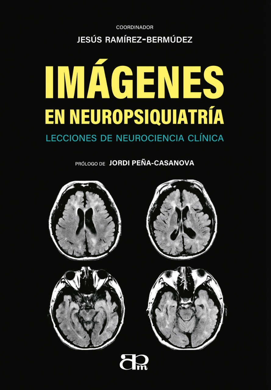 IMÁGENES EN NEUROPSIQUIATRÍA (Pasta Blanda)